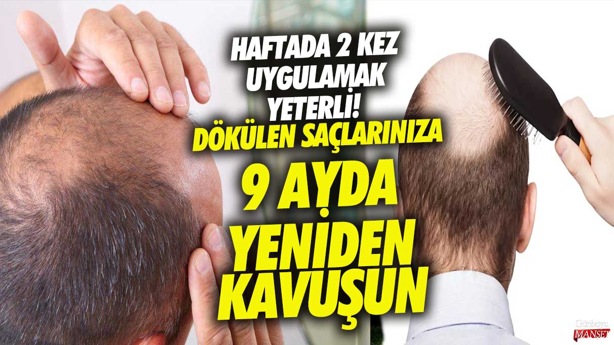 Saç dökülmenizi 9 ayda durdurun ve saçlarınıza yeniden kavuşun! Sadece haftada 2 kez uygulayarak başlayabilirsiniz.