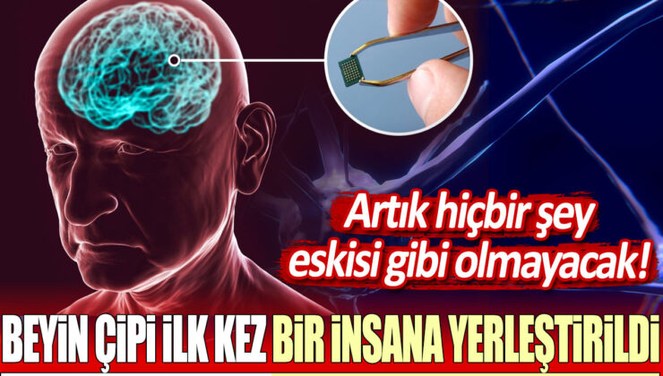 İnsana İlk Kez Yerleştirilen Neuralink Beyin Çipi, Geleceği Değiştirecek!