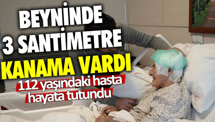 112 yaşındaki hasta yaşamı tehdit eden 3 cm kalınlığında beyin kanaması ile mücadele ediyor