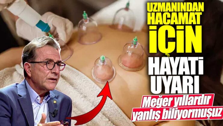 Hacamat uygulaması için uzmandan hayati uyarı: Yıllardır yanlış bilinenler ortaya çıktı