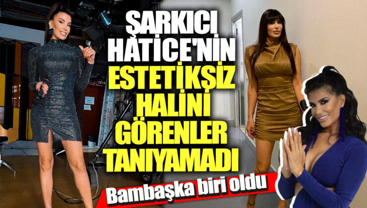 Estetik Operasyonlarla Değişen Hatice’nin Şaşırtıcı Görünümü!