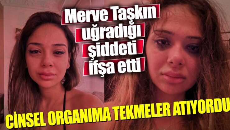 Merve Taşkın’ın Şiddet İtirafı: Sevgilisi Tehdit Etmiş!