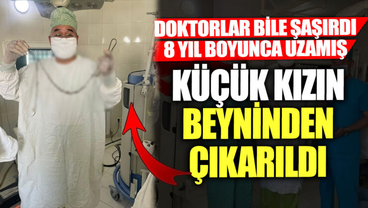 Doktorlar bile şaşırdı! 8 yıl boyunca büyüyen küçük kızın beyninden çıkarıldı