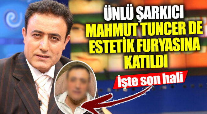 Ünlü Şarkıcıların Estetik Operasyon Çılgınlığı: Mahmut Tuncer’in Şok Edici Değişimi!