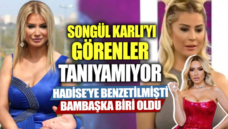 Songül Karlı’nın Estetik Değişimi Şaşırtıyor! İşte Son Hali